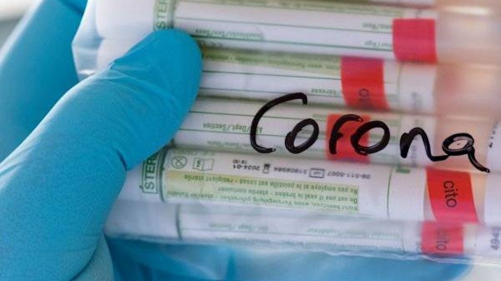 51.299 Corona-Neuinfektionen werden registriert – Inzidenz liegt am Mittwochmorgen bei 236,2