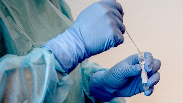 Ministerium: PCR-Testkapazitäten sind begrenzt