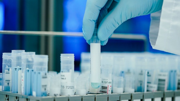 Gesundheitsminister: In vielen Fällen kein PCR-Test mehr 