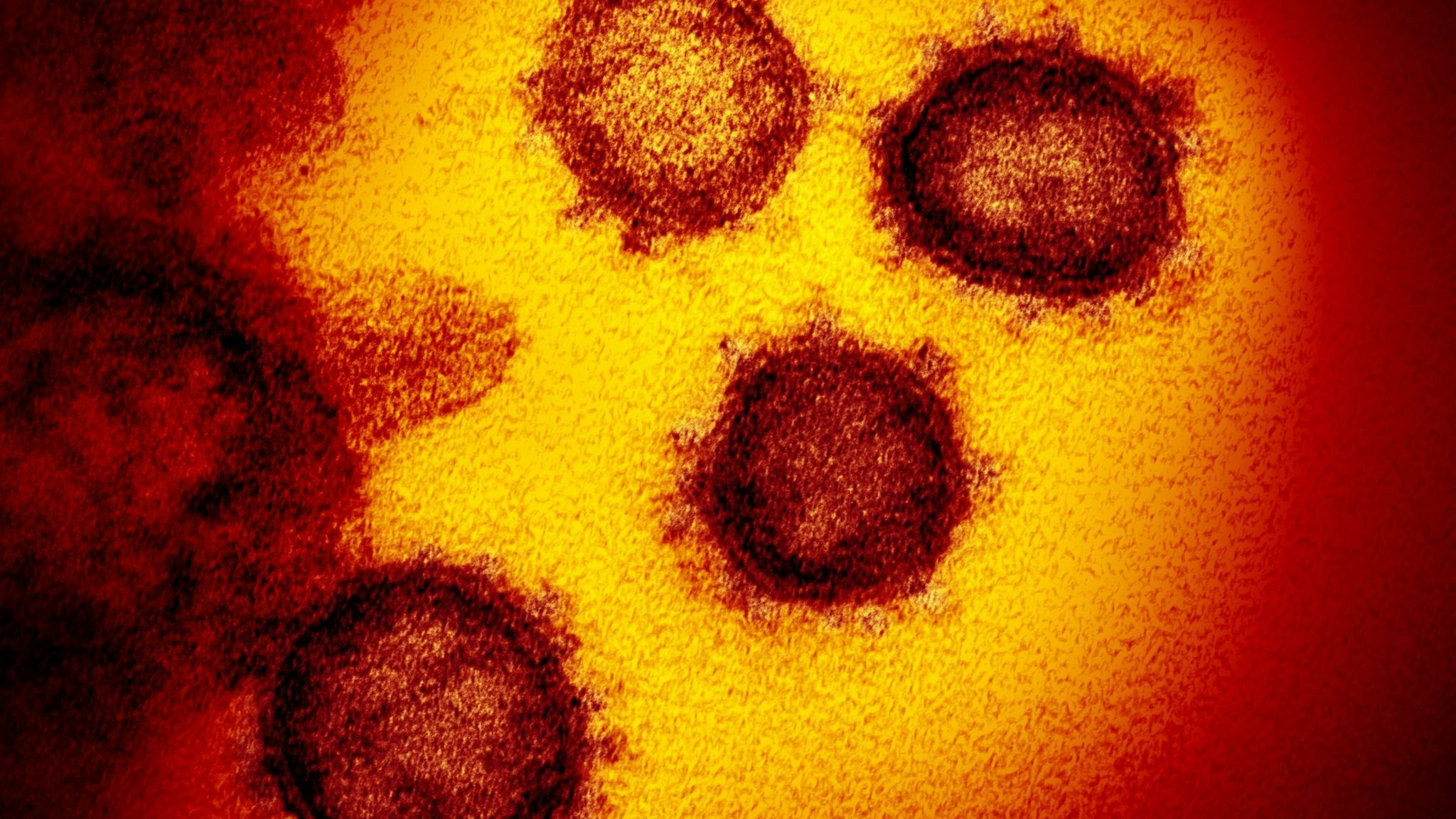 Die vom National Institute of Allergy and Infectious Diseases zur Verfügung gestellte Elektronenmikroskopaufnahme zeigt das Coronavirus SARS-CoV-2. Foto: dpa/Niaid-Rml/ZUMA Wire