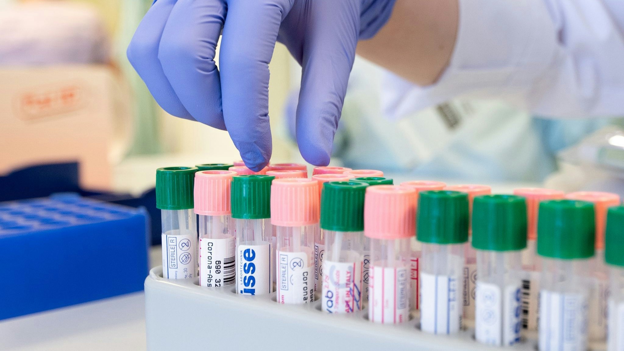 Labormitarbeiterinnen etikettieren im Medizinischen Labor Ostsachsen Corona-Abstriche zum Virusnachweis mit der PCR-Methode. Foto: dpa/Kahnert
