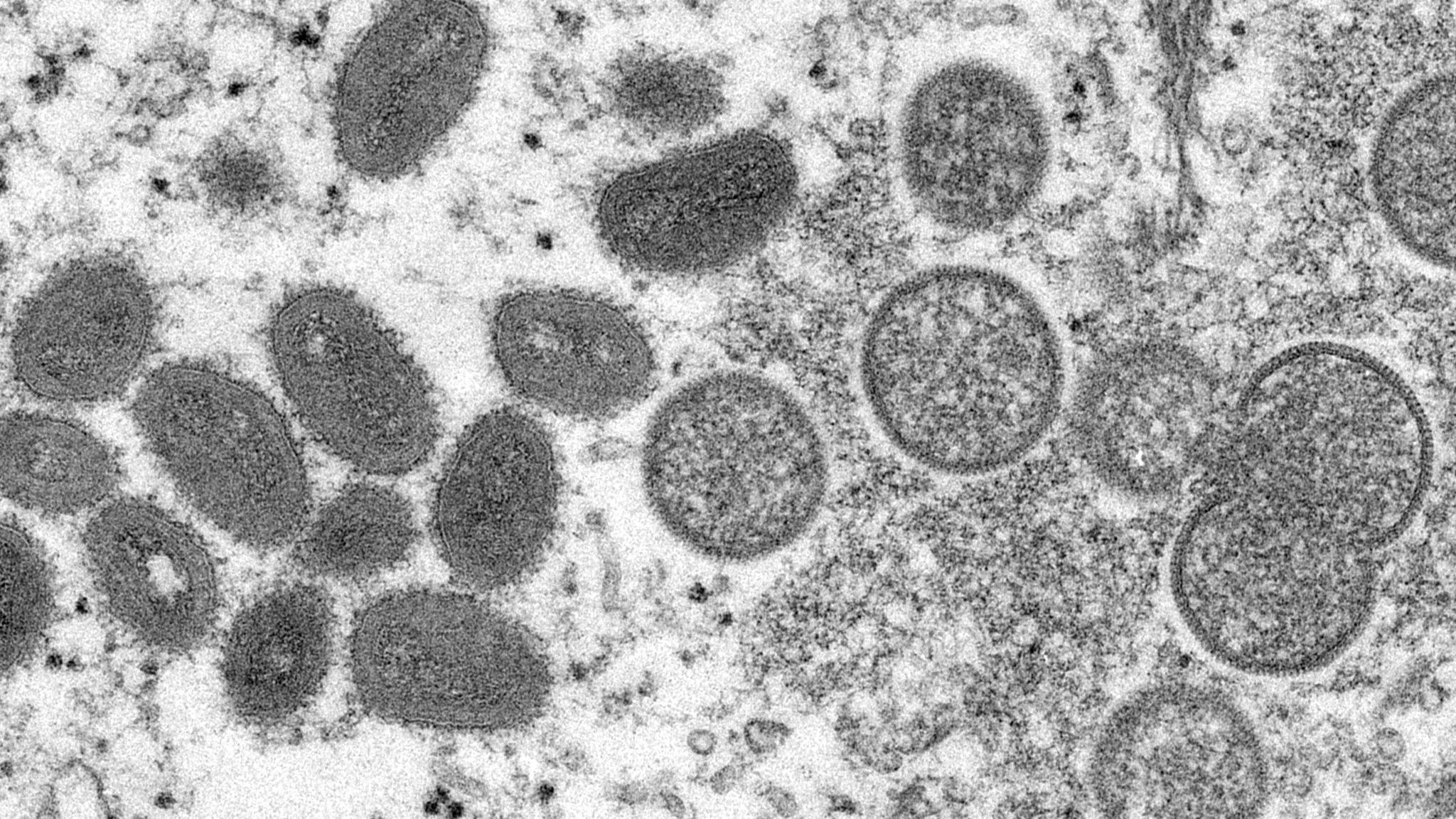 Der Affenpocken-Ausbruch gilt nun als "Notlage von internationaler Tragweite". Foto: dpa/Goldsmith